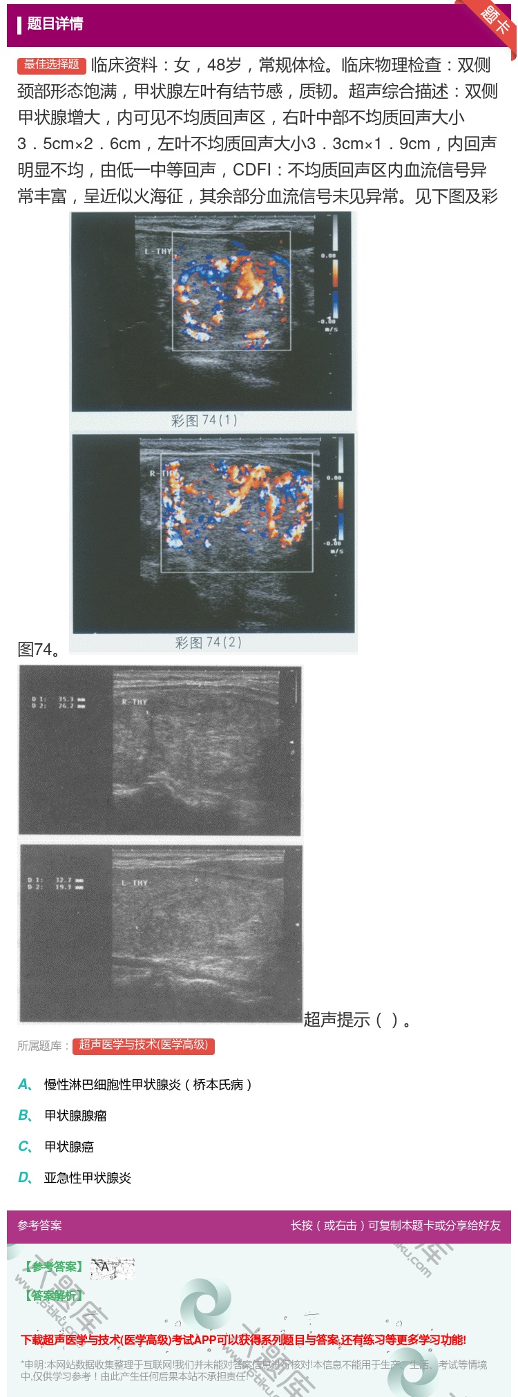 答案:临床资料女48岁常规体检临床物理检查双侧颈部形态饱满甲状腺左...