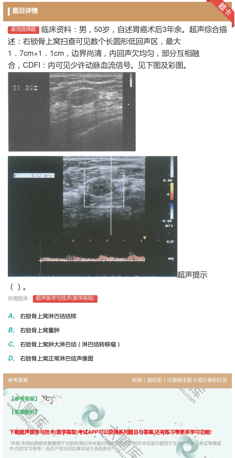 答案:临床资料男50岁自述胃癌术后3年余超声综合描述右锁骨上窝扫查...