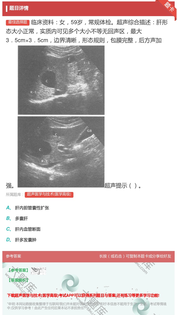 答案:临床资料女59岁常规体检超声综合描述肝形态大小正常实质内可见...