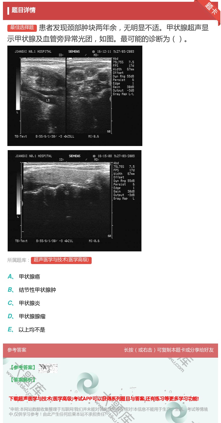 答案:患者发现颈部肿块两年余无明显不适甲状腺超声显示甲状腺及血管旁...