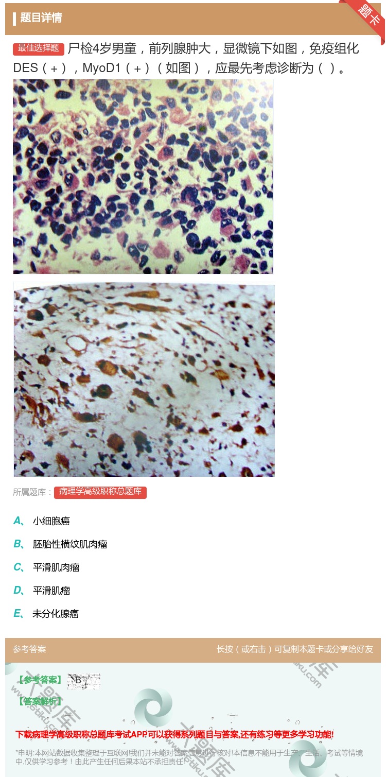 答案:尸检4岁男童前列腺肿大显微镜下如图免疫组化DES+MyoD1...