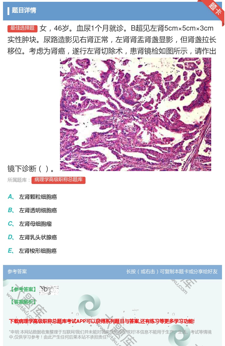 答案:女46岁血尿1个月就诊B超见左肾5cm×5cm×3cm实性肿...
